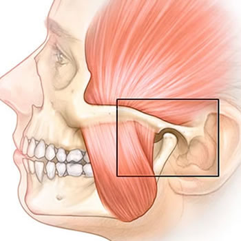 κροταφογναθική διάρθρωση,δυσλειτουργία κροταφογναθικής διάρθρωσης,σύνδρομο κροταφογναθικής διάρθρωσης